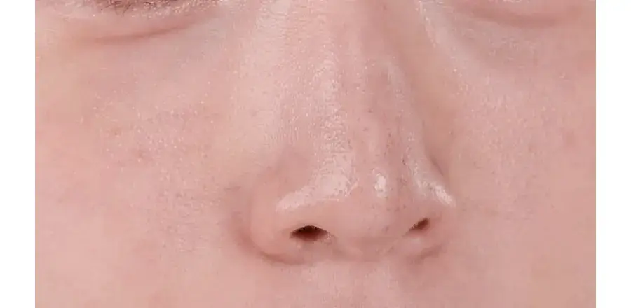 [모공전용딥클렌징] 메디필 레드 락토 콜라겐 클렌징 오일 2.0 200ml 상세페이지 16